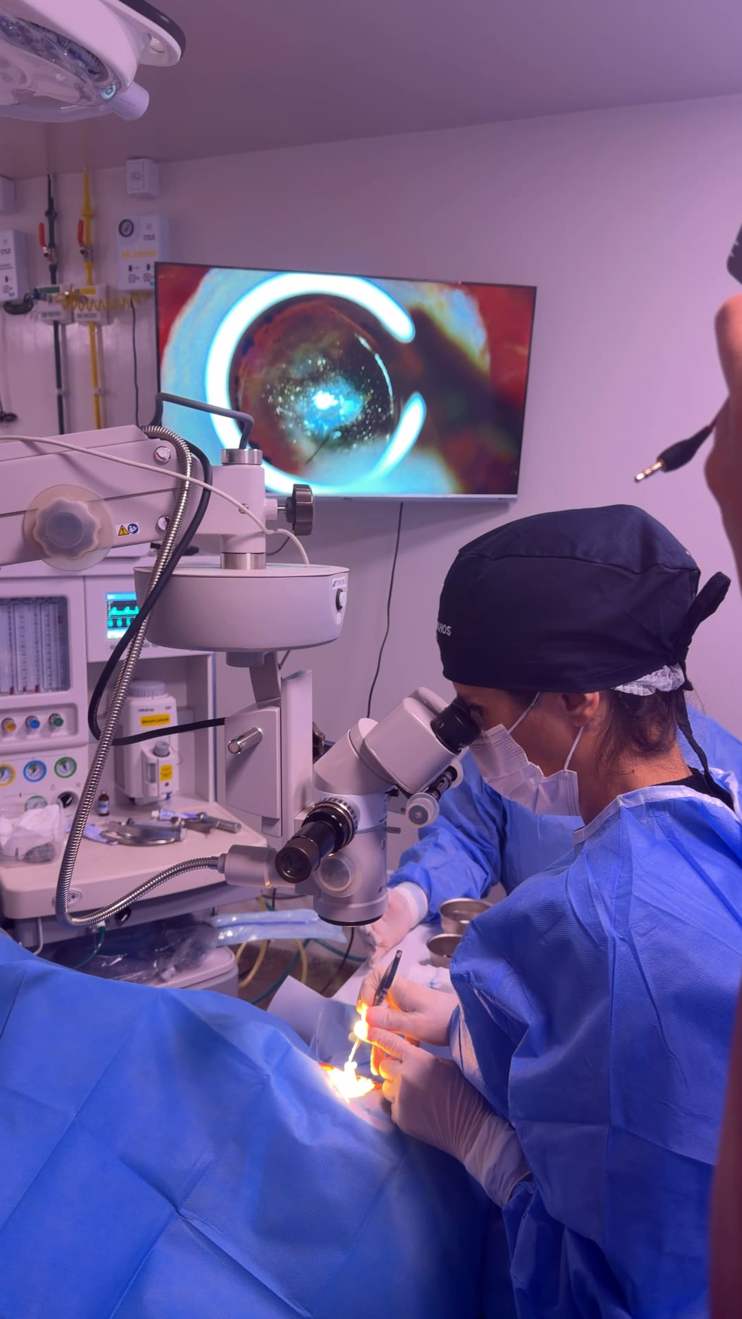 São Mateus faz o primeiro transplante de córnea do Norte do ES